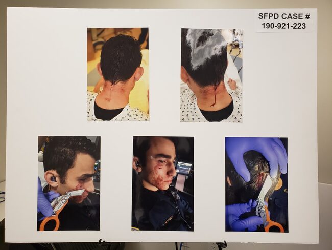 Photo of Officer Injuries Sustained